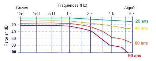 audiogramme-presbyacousie.png